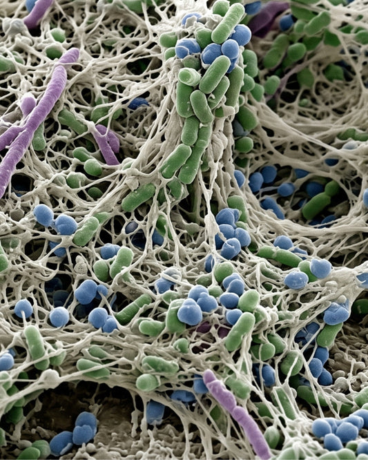 Beyond Scraping: Why Subgingival Biofilm Is the Real Enemy of Canine Health